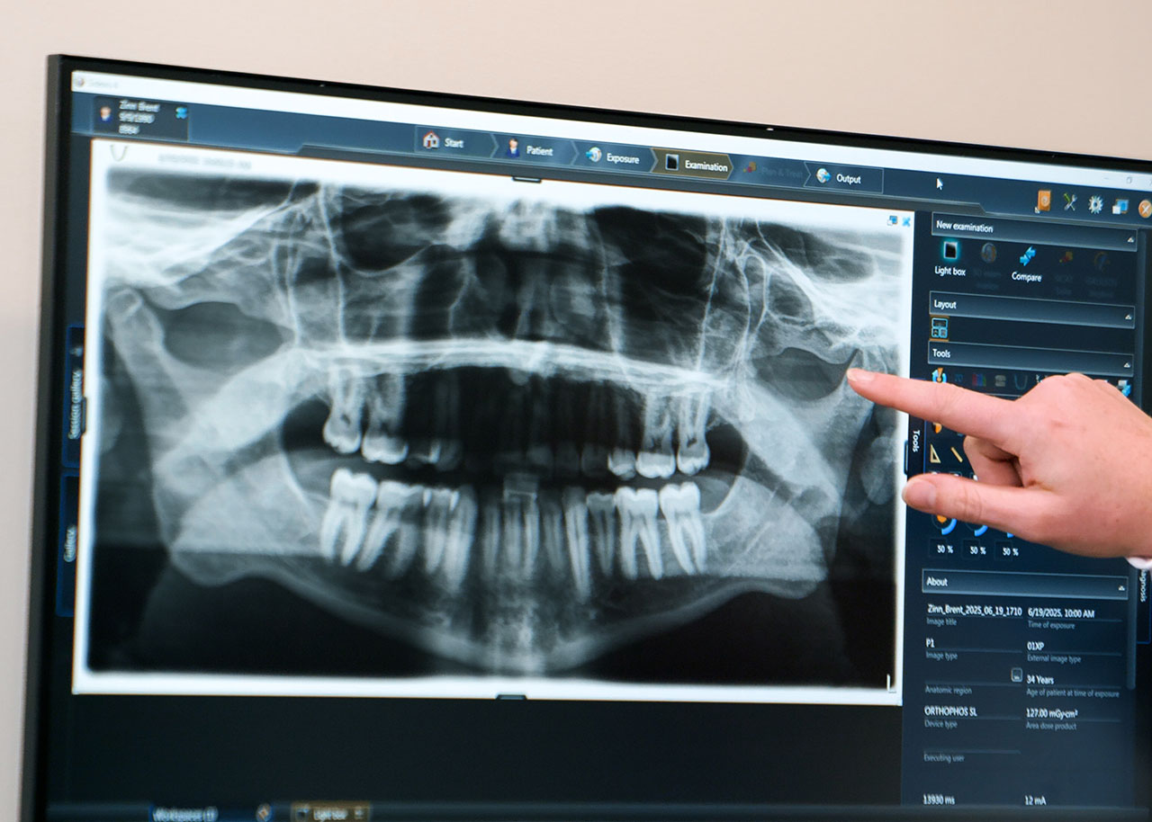 All-on-X Dental Implant Dentist in Kentwood MI